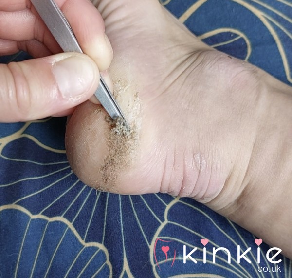 SOLD - Ready Now! 🦶 Foot Scrapings & 3 Videos