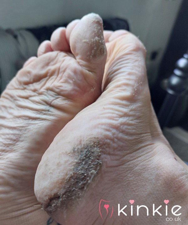 SOLD - Ready Now! 🦶 Foot Skin, Photos & Videos